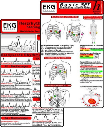 EKG Basic Set (er Set) - Herzrhythmusstörungen, EKG Auswertung - Medizinische Taschen-Karte, niet bekend - Paperback - 9783869572741