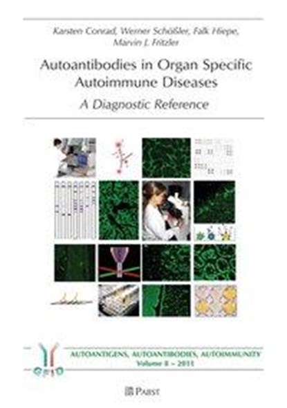 Conrad, K: Autoantibodies in Organ Specific Autoimmune Disea, CONRAD,  Karsten ; Schößler, Werner ; Hiepe, Falk ; Fritzler, Marvin J. - Paperback - 9783899677348