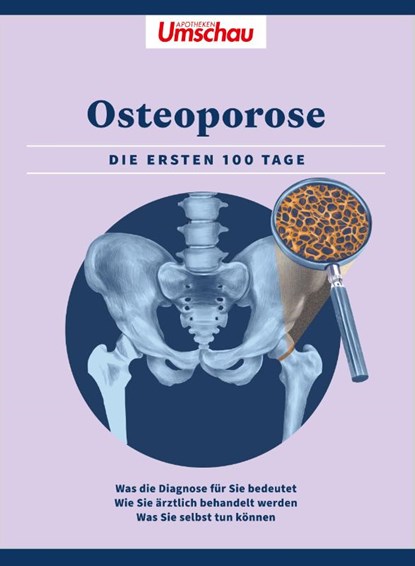 Apotheken Umschau: Osteoporose, Wort & Bild Verlag - Paperback - 9783927216693