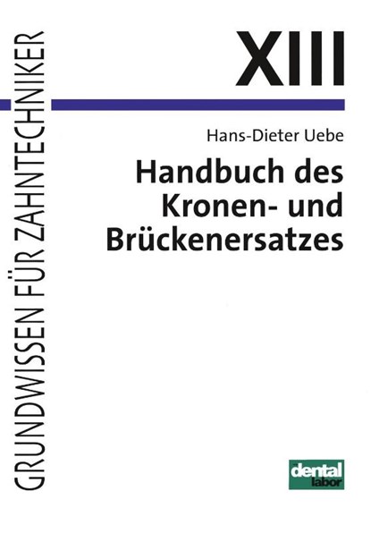 Handbuch des Kronen- und Brückenersatzes, Hans-Dieter Uebe - Paperback - 9783929360097