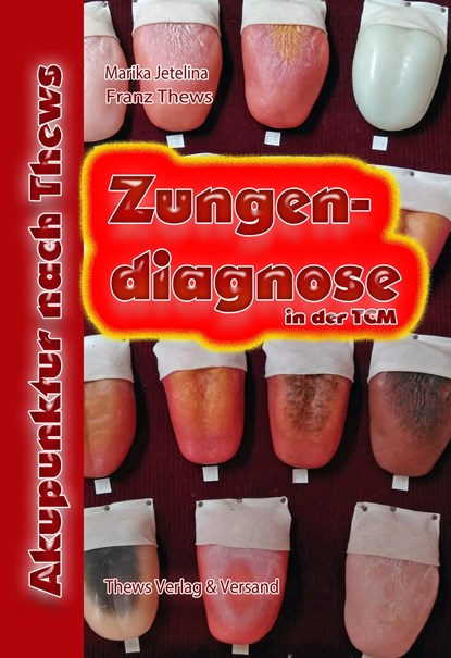 Zungendiagnose in 54 Bildern, Franz Thews ;  Marika Jetelina - Gebonden - 9783936456141
