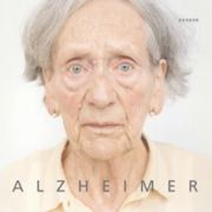 Alzheimer, RIBBAT,  Christoph - Gebonden - 9783936636345