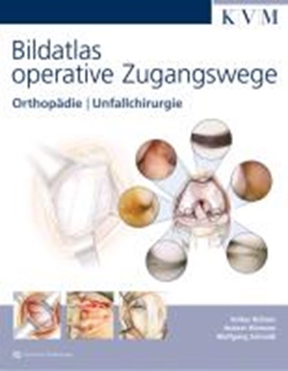 Bildatlas operative Zugangswege (inkl. DVD), BÜHREN,  Volker ; Hörterer, Hubert ; Schmidt, Wolfgang - Gebonden - 9783940698728