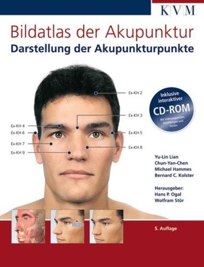Bildatlas der Akupunktur, Yu-Lin Lian ; Chun Yan-Chen ; Michael Hammes ; Bernhard C. Kolster - Gebonden - 9783940698964
