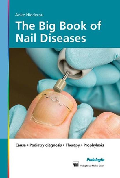 The Big Book of Nail Diseases, Anke Niederau - Gebonden - 9783954090495