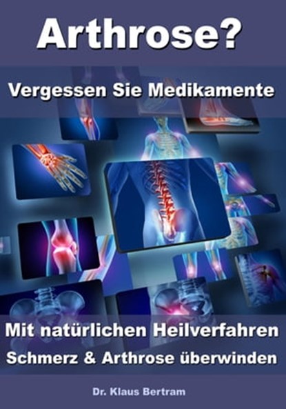 Arthrose? – Vergessen Sie Medikamente – Mit natürlichen Heilverfahren Schmerz & Arthrose überwinden, Dr. Klaus Bertram - Ebook - 9783955774950