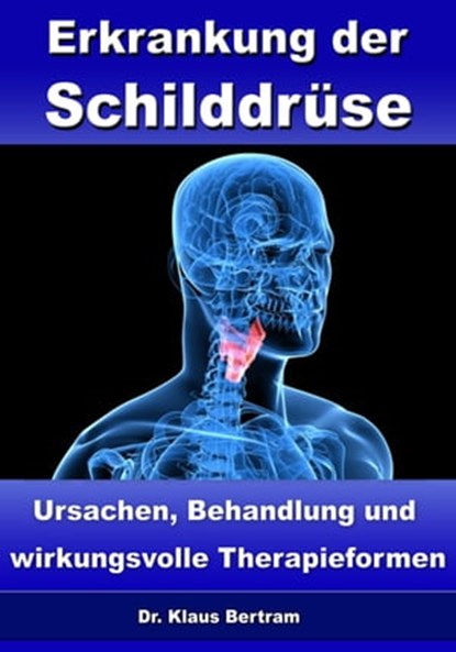 Erkrankung der Schilddrüse – Ursachen, Behandlung und wirkungsvolle Therapieformen, Dr. Klaus Bertram - Ebook - 9783955774998