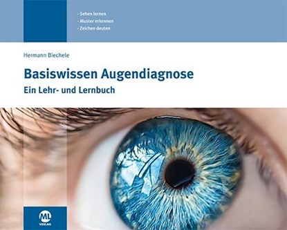 Basiswissen Augendiagnose, Hermann Biechele - Gebonden - 9783964742148
