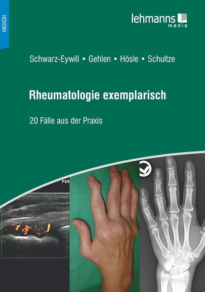 Rheumatologie exemplarisch, Michael Schwarz-Eywill ;  Martin Gehlen ;  Rosmarie Hösle ;  Mareen Schultze - Paperback - 9783965430624
