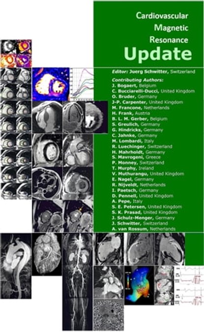 Cardiovascular Magnetic Resonance Update, J. Schwitter ; J. Bogaert ; C. Bucciarelli-Ducci ; O. Bruder ; J-P. Carpenter ; M. Francone ; H. Frank ; B.L.M. Gerber ; S. Greulich ; G. Hindricks ; C. Jahnke ; M. Lombardi ; R. Luechinger ; H. Mahrholdt ; S. Mavrogeni ; P. Monney ; T. Murphy ; V. Muthur - Ebook - 9783987563386