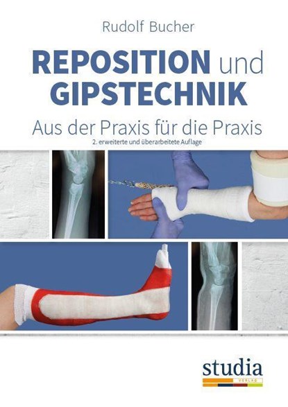 Reposition und Gipstechnik II, Rudolf Bucher - Paperback - 9783991050209