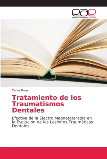 Tratamiento de los Traumatismos Dentales, Carlos Rojas - Paperback - 9786202146074