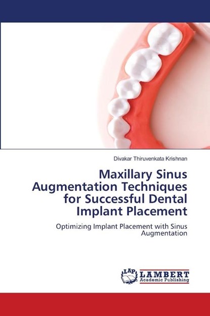 Maxillary Sinus Augmentation Techniques for Successful Dental Implant Placement, Divakar Thiruvenkata Krishnan - Paperback - 9786206158387