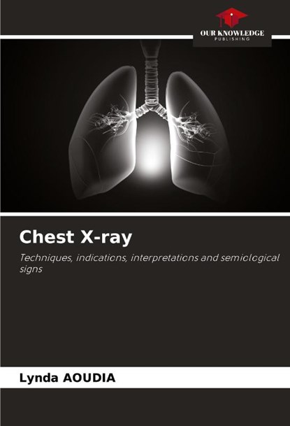 Chest X-ray, Lynda Aoudia - Paperback - 9786208570392