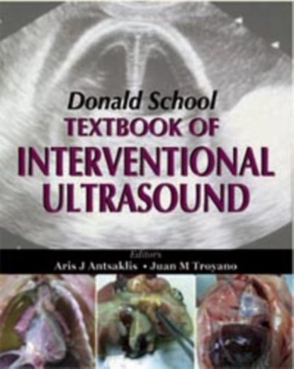 Donald School Textbook of Interventional Ultrasound, AJ Antsaklis ; JM Troyano ; Frank A Chervenak - Gebonden - 9788184482980