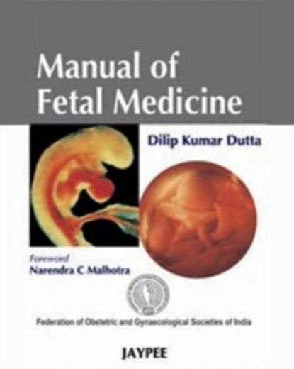 Manual of Fetal Medicine, DK Dutta - Paperback - 9788184485882