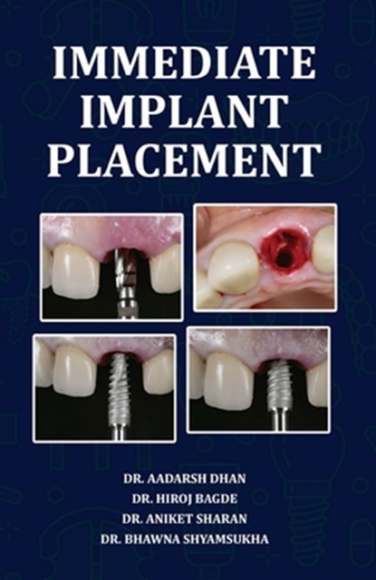Immediate Implant Placement, Aadarsh Dhan - Paperback - 9788197792724