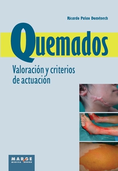 Quemados. Valoración y criterios de actuación, Ricardo Palao Doménech - Paperback - 9788415340140