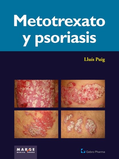 Metotrexato y psoriaris, Lluís Puig Sanz - Paperback - 9788415340409