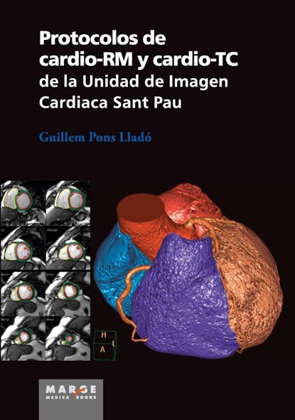 Protocolos de cardio-RM y cardio-TC de la Unidad de Imagen Cardiaca Sant Pau, Guillem Pons Lladó - Paperback - 9788415340621