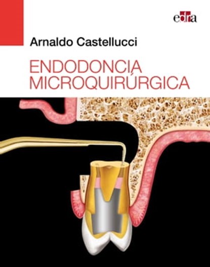 Endodoncia microquirúrgica, Arnaldo Castellucci - Ebook - 9788418498428