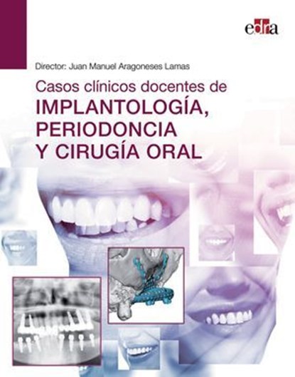 Casos clínicos docentes de IMPLANTOLOGÍA, PERIODONCIA Y CIRUGÍA ORAL, Juan Manuel Aragoneses ; Rosa María Acevedo Ocaña ; Mario Alvarado-Lorezo ; David Alfaro Aroca - Ebook - 9788418706561