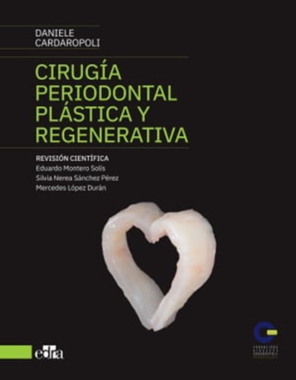 Cirugía periodontal plástica y regenerativa, Daniele Cardaropoli - Ebook - 9788419156747