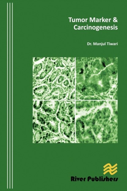 Tumor Marker and Carcinogenesis, Manjul Tiwari - Gebonden - 9788792329370