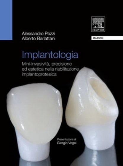 Implantologia, Alberto Barlattani ; Alessandro Pozzi - Ebook - 9788821433436