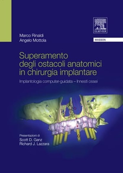 Superamento degli ostacoli anatomici in chiurgia implantare, Angelo Mottola ; Marco Rinaldi - Ebook - 9788821433566