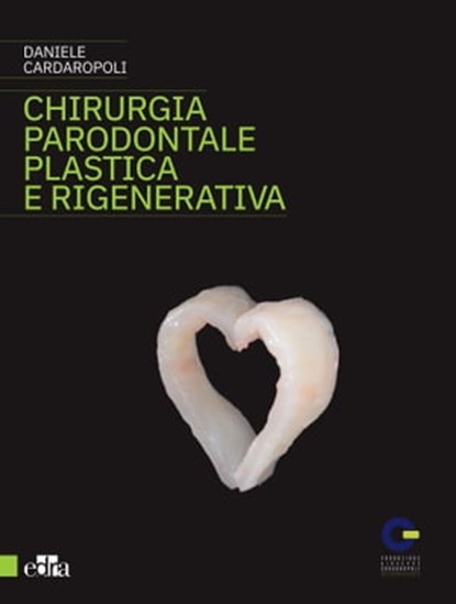 Chirurgia parodontale plastica e rigenerativa, Daniele Cardaropoli - Ebook - 9788821450228
