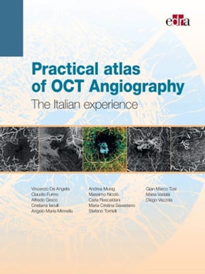 Practical atlas of OCT Angiography, Vincenzo De Angelis ; Claudio Furino ; Alfredo Greco ; Cristiana Iaculli ; Angelo Maria Minnella ; Andrea Musig ; Massimo Nicolò ; Carla Rescaldani ; Maria Cristina Savastano ; Stefano Torrielli ; Gian Marco Tosi ; Maria Vadalà ; Diego Vezzola - Ebook - 9788821450402