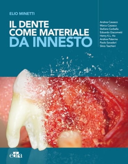 Il dente come materiale da innesto, Elio Minetti ; Andrea Carasco ; Marco Carasco ; Edoardo Giacometti ; Henry K.L. Ho ; Andrea Palermo ; Paolo Savadori ; Silvio Taschieri - Ebook - 9788821453540