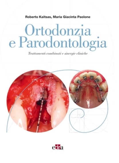 Ortodonzia e parodontologia, Roberto Kaitsas ; Maria Giacinta Paolone - Ebook - 9788821453670