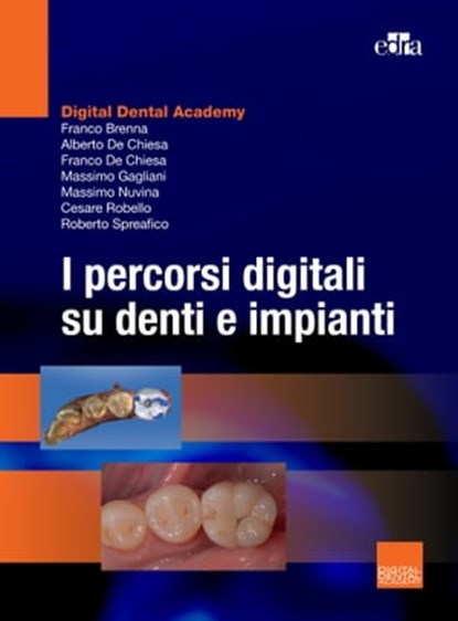 I percorsi digitali su denti e impianti, Franco Brenna ; Franco De Chiesa ; Alberto De Chiesa ; Massimo Gagliani ; Massimo Nuvina ; Cesare Robello ; Roberto Spreafico - Ebook - 9788821456244