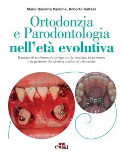 Ortodonzia e Parodontologia nell'età evolutiva, Maria Giacinta Paolone ; Roberto Kaitsas - Ebook - 9788821456411