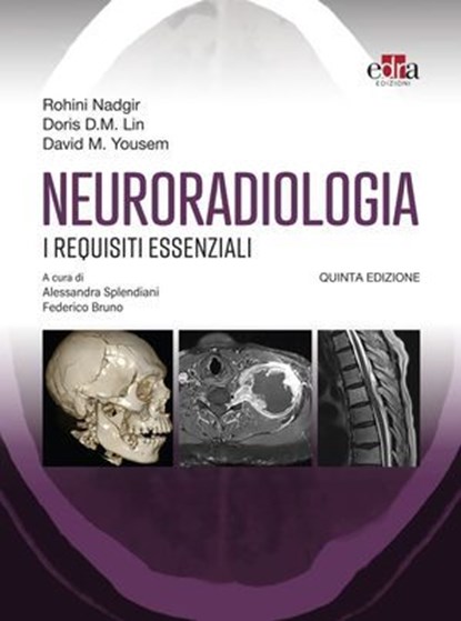 Neuroradiologia, Rohini Nadgir ; Doris D.M. Lin ; David M. Yousem - Ebook - 9788821459191