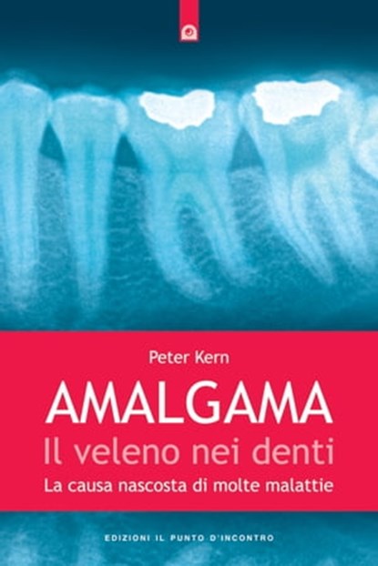 Amalgama: il veleno nei denti, Peter Kern - Ebook - 9788868202286