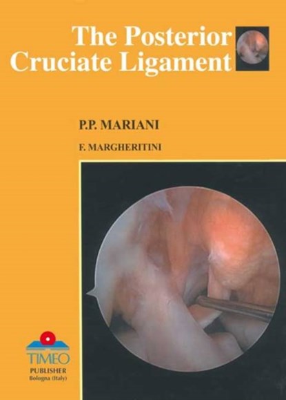 Posterior Cruciate Ligament, Pier Paolo Mariani - Gebonden - 9788886891707