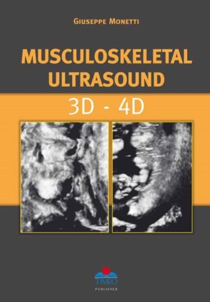 Musculoskeletal Ultrasound 3D - 4D, G Monetti - Gebonden - 9788897162070