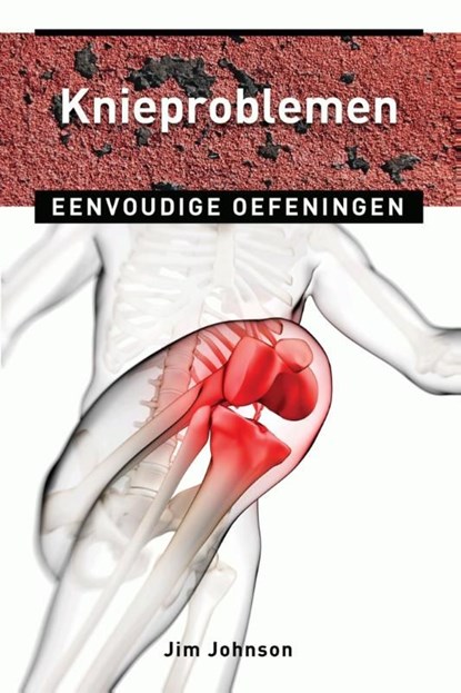 Knieproblemen, Jim Johnson - Ebook - 9789020209709