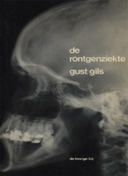 De röntgenziekte, Gust Gils - Ebook - 9789023474319