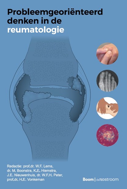 Probleemgeoriënteerd denken in de reumatologie, W.F. Lems - Paperback - 9789024458530