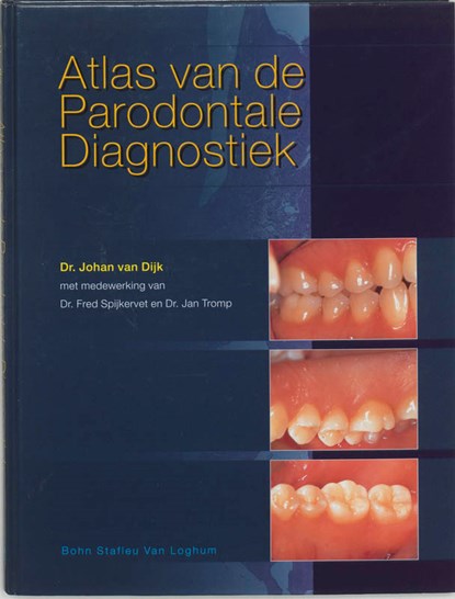 Atlas van de parodontale diagnostiek, J. van Dijk - Gebonden - 9789031332960