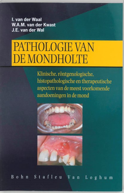 Pathologie van de mondholte, I. van der Waal ; W.A.M. van der Kwast ; J.E. van der Wal - Paperback - 9789031338740