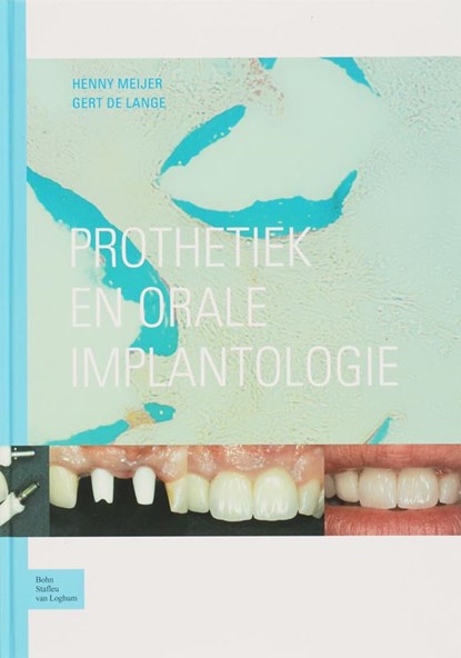 Prothetiek en orale implantologie, H. Meijer ; G. de Lange - Gebonden - 9789031341436