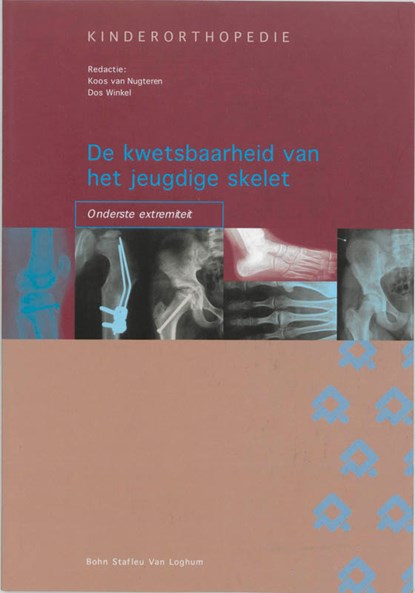 De kwetsbaarheid van het jeugdige skelet: onderste extremiteit, K. van Nugteren ; D. Winkel - Paperback - 9789031344093