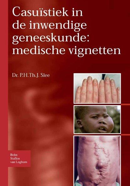 Casuïstiek in de inwendige geneeskunde: medische vignetten, P. H. Th. J. Slee - Paperback - 9789031352289
