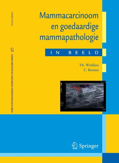 Mammacarcinoom en goedaardige mammapathologie in beeld, T. Wobbes ; C. Boetes - Paperback - 9789031362622