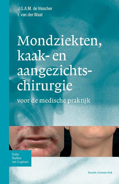 Zakboek mondziekten, kaak- en aangezichtchirurgie, J.G.A.M. de Visscher ; I. van de Waal - Paperback - 9789031363308